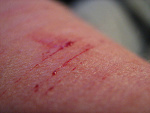 Fotoblog fuckingxxgirlfriend