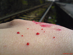 Fotoblog patexxd