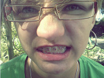 Fotoblog mimiczna