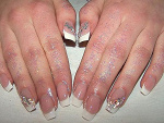 Fotoblog dysianails