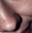 Fotoblog kindorex