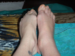 Fotoblog abanana1