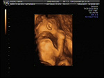 Fotoblog xczasoumilaczx