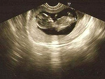 Fotoblog vissnia