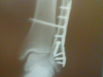 Fotoblog gonia22