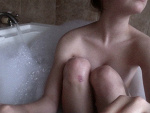 Fotoblog selfhurting