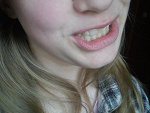 Fotoblog klofcia