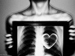 Fotoblog dylabmx