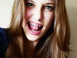 Fotoblog migglyway