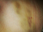 Fotoblog gonnadiex3