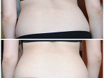 Fotoblog bodyworkout