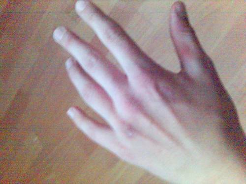 Myyy handd :P:P 