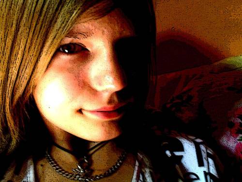 Sylwia bez oka ;]