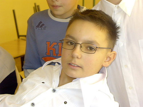 xD
