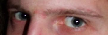 Eyes