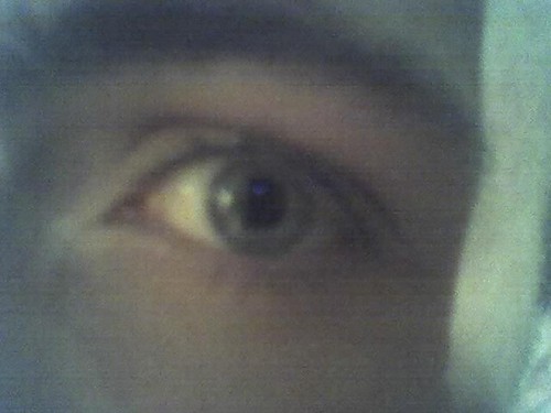 blue eyes