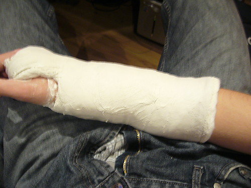 arm injury xDD