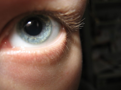 look at my eye.