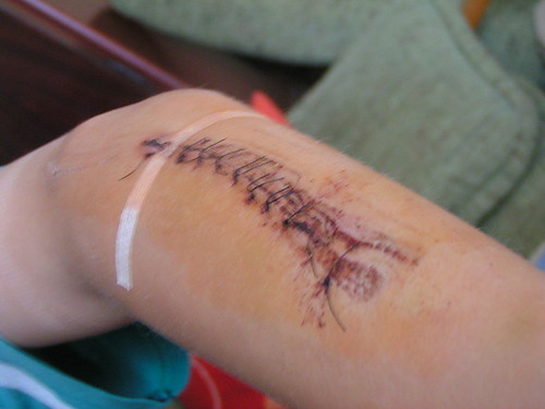 My hand !!