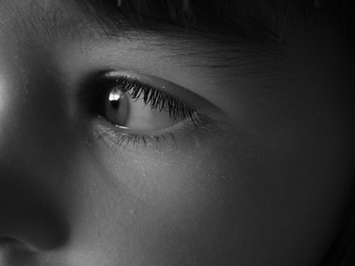 Eye