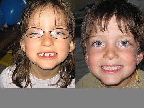 Byam u dentysty .....