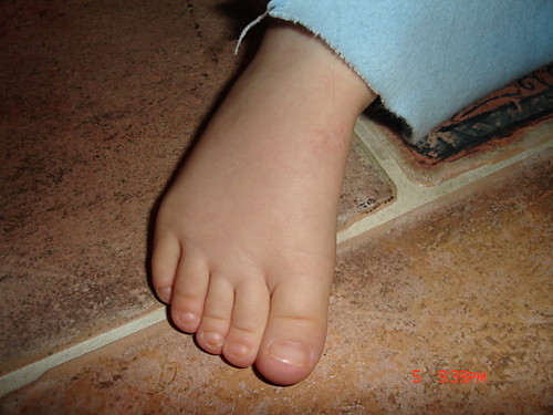 topa 