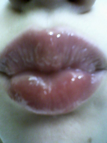 :*