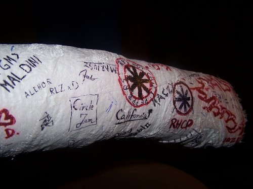 Gips...