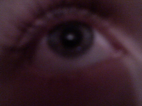 My Eye :)