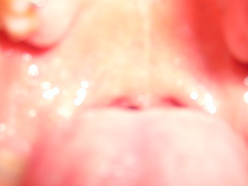 :P