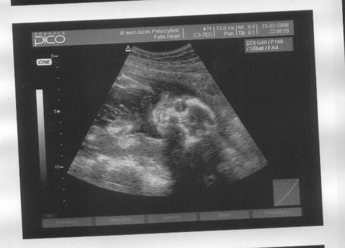 Dzidzka:) 19.02.2008