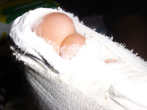 gips