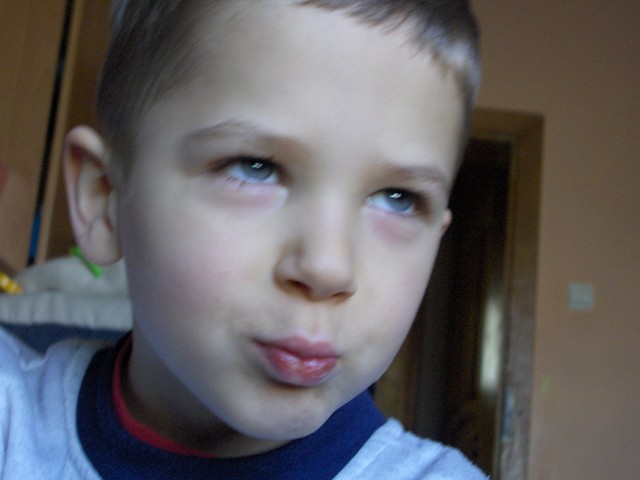 :*