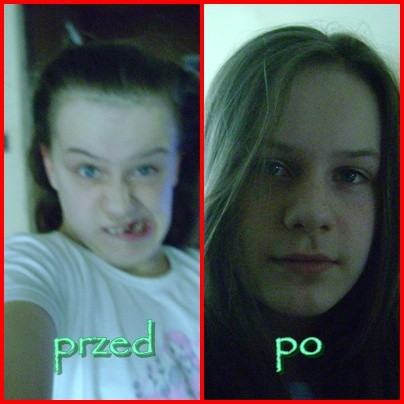 przed i po