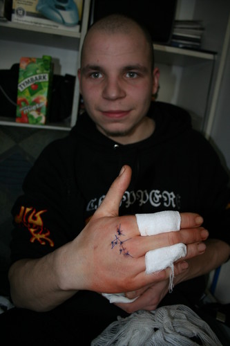 W trakcie leczenia;p