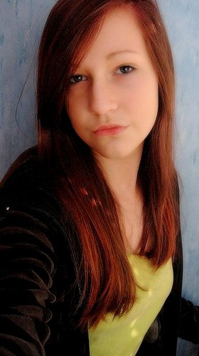 fire! your hair.