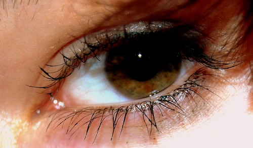 My eye