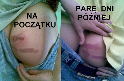 URODZINY