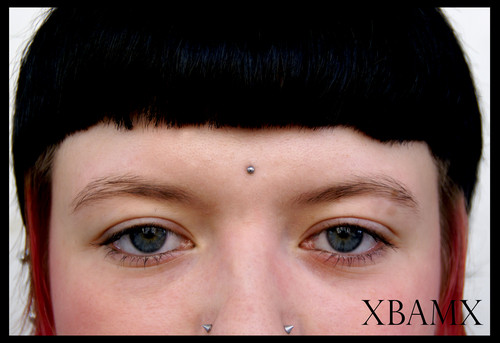 microdermal
