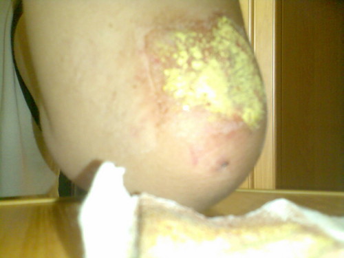 Asfalt 1:0 okie  ;/