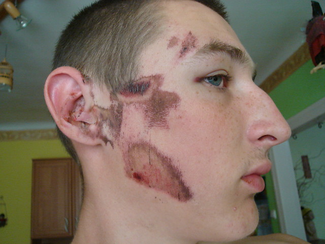 HS