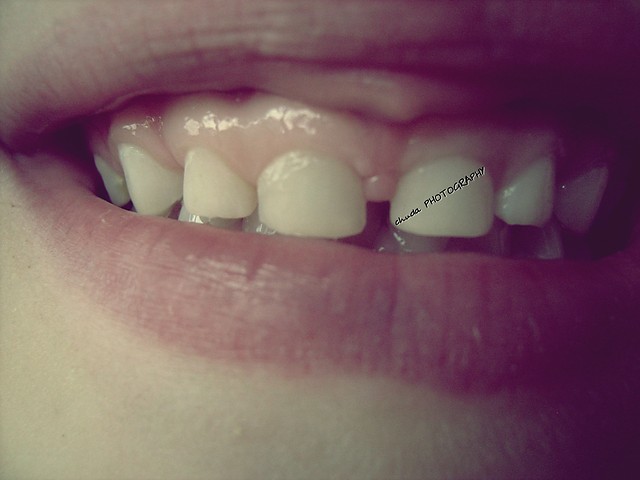 uhhh co za umiech :D