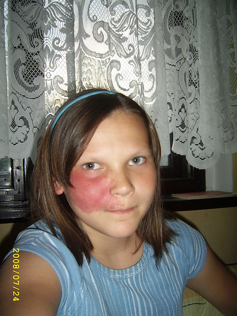 p. agata:*
