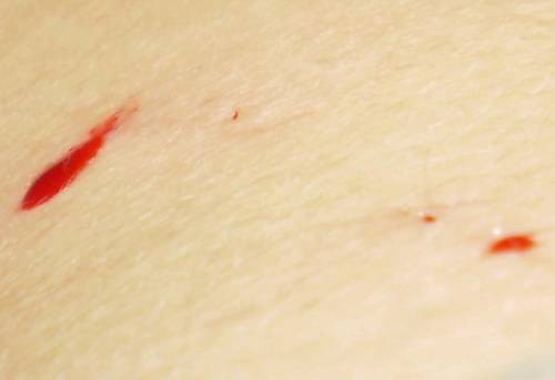 Blood blood blood