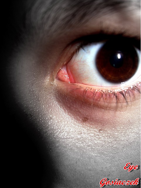 eye