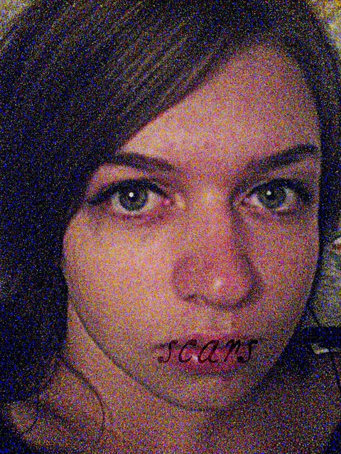scars