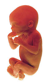 Aborcja