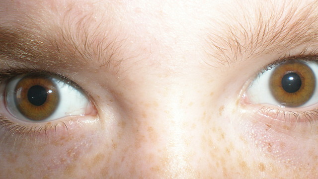 eye