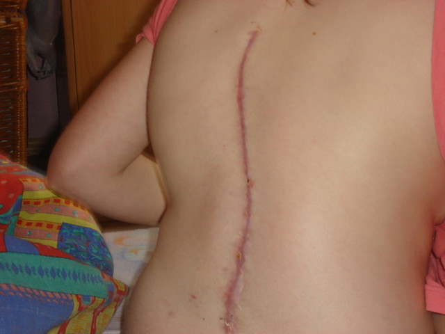 2.To jest ochydne ;/