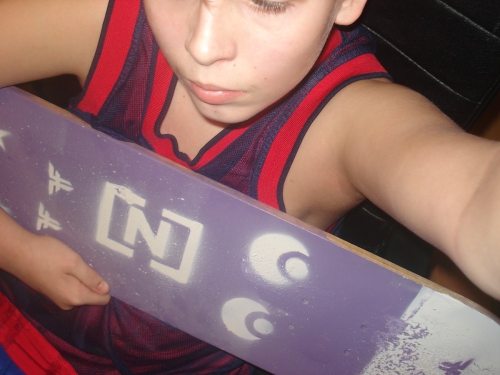 yyyy jakis problem;d